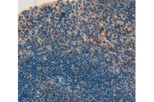 IHC-P analysis of Human Tissue, with DAB staining. (CD226 Antikörper  (AA 19-254))