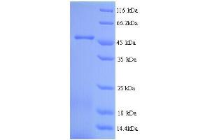 SDS-PAGE (SDS) image for Major Royal Jelly Protein 1 (MRJP1) (AA 20-432) protein (His tag) (ABIN5714288)