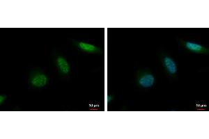 ICC/IF Image MCAK antibody [N1N3] detects MCAK protein at nucleus by immunofluorescent analysis. (KIF2C Antikörper)