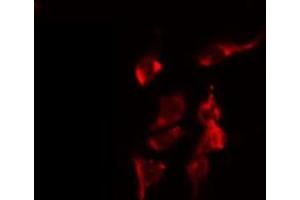 ABIN6274740 staining COLO205 by IF/ICC. (MRPL40 Antikörper  (C-Term))