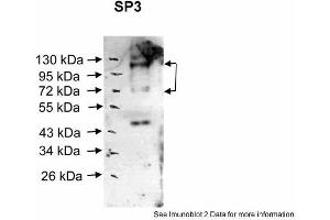 Sample Type: Human nuclear cell extracts (30ug)Primary Dilution: 1:1000Secondary Antibody: anti-Rabbit HRPSecondary Dilution: 1:20000Image Submitted By:  Katarina LuciakovaCancer Research Institute .