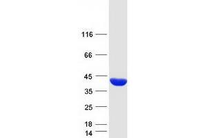 Western Blotting (WB) image for Fructose-1,6-Bisphosphatase 1 (FBP1) (Transcript Variant 1) protein (Myc-DYKDDDDK Tag) (ABIN2720918)