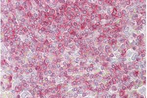 Immunohistochemistry with Spleen tissue at an antibody concentration of 5µg/ml using anti-RIPK3 antibody (AVARP00031_P050) (RIPK3 Antikörper  (Middle Region))