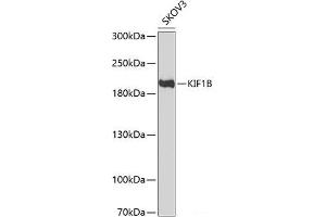 Western blot analysis of extracts of SKOV3 cells using KIF1B Polyclonal Antibody at dilution of 1:1000. (KIF1B Antikörper)