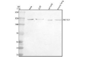 Western blot analysis of TBC1D1 using anti-TBC1D1 antibody (ABIN7825921).