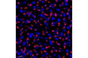 Immunofluorescence (Paraffin-embedded Sections) (IF (p)) image for anti-Homer Homolog 3 (Drosophila) (HOMER3) antibody (ABIN7074257)