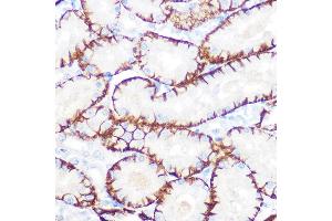 Immunohistochemistry of paraffin-embedded rat kidney using NDRG1 Rabbit mAb (ABIN7268783) at dilution of 1:100 (40x lens). (NDRG1 Antikörper)