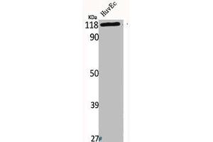 Western Blot analysis of HuvEc cells using Bek Polyclonal Antibody (FGFR2 Antikörper  (Internal Region))