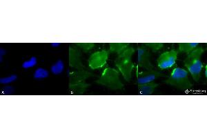 Immunocytochemistry/Immunofluorescence analysis using Mouse Anti-CD74 Monoclonal Antibody, Clone PIN 1. (CD74 Antikörper  (Atto 594))