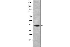 Western blot analysis OR1D4/5 using HeLa whole cell lysates (OR1D4/5 Antikörper)