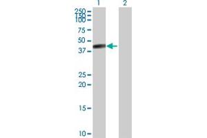 Western Blot analysis of CPB1 expression in transfected 293T cell line by CPB1 MaxPab rabbit polyclonal antibody. (CPB1 Antikörper  (AA 1-417))