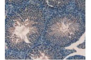 Immunohistochemistry (IHC) image for anti-Glutathione Peroxidase 4 (GPX4) (AA 74-197) antibody (ABIN7439558)