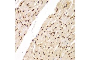 Immunohistochemistry of paraffin-embedded human colon using SUPT20H antibody (ABIN5975125) at dilution of 1/100 (40x lens). (FAM48A/P38IP Antikörper)