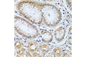 Immunohistochemistry of paraffin-embedded human stomach using CPM antibody (ABIN6128978, ABIN6138956, ABIN6138957 and ABIN6222238) at dilution of 1:100 (40x lens). (CPM Antikörper  (AA 204-443))