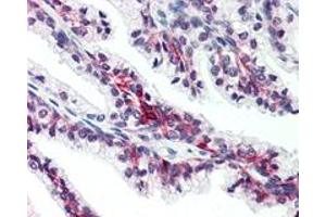 Immunohistochemistry (Formalin/PFA-fixed paraffin-embedded sections) of human prostate with SLC39A6 polyclonal antibody .
