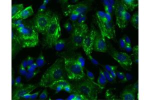 Immunofluorescent staining of SK-N-SH cells. (PRKAR2B Antikörper  (pSer114))