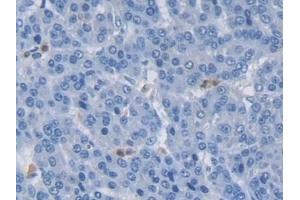 Immunohistochemistry (IHC) image for anti-E3 ubiquitin-protein ligase MIB2 (MIB2) (AA 687-930) antibody (ABIN7439483)