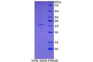 SDS-PAGE analysis of Pig FTH Protein. (Ferritin, Heavy Polypeptide 1 (FTH1) Peptid)