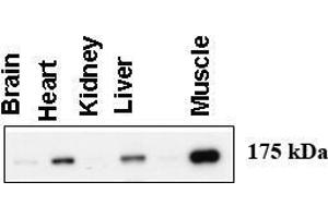 Image no. 1 for anti-Amylo-alpha-1, 6-Glucosidase, 4-alpha-Glucanotransferase (AGL) (AA 1487-1516), (C-Term) antibody (ABIN357688) (AGL Antikörper  (C-Term))