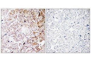 Immunohistochemistry (IHC) image for anti-Coiled-Coil Domain Containing 102B (CCDC102B) (Internal Region) antibody (ABIN1851142) (CCDC102B Antikörper  (Internal Region))