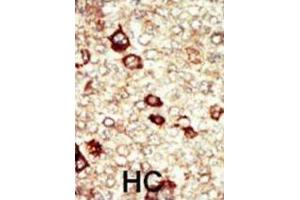 Immunohistochemistry (IHC) image for anti-Fibroblast Growth Factor Receptor 4 (FGFR4) antibody (ABIN3003375) (FGFR4 Antikörper)