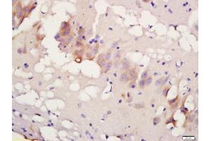 Formalin-fixed and paraffin embedded rat brain labeled with Rabbit Anti-TBK1 (Ser172) Polyclonal Antibody, Unconjugated 1:200 followed by conjugation to the secondary antibody and DAB staining (TBK1 Antikörper  (pSer172))