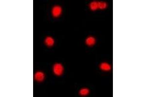 Immunofluorescent analysis of C/EBP gamma staining in Jurkat cells. (CEBPG Antikörper)