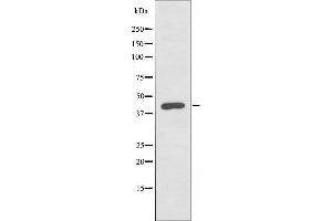 Western blot analysis of extracts from COLO cells, using ABHD12 antibody. (ABHD12 Antikörper)