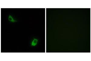 Immunofluorescence analysis of LOVO cells, using FPRL2 antibody. (FPR3 Antikörper  (C-Term))