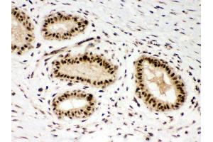 Immunohistochemistry (IHC) image for anti-PDZ Binding Kinase (PBK) (AA 71-322) antibody (ABIN3043592)