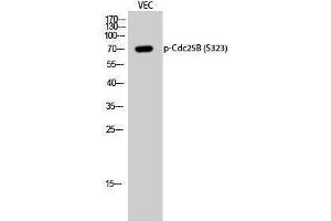 Western Blotting (WB) image for anti-Cell Division Cycle 25 Homolog B (S. Pombe) (CDC25B) (pSer323) antibody (ABIN3181956) (CDC25B Antikörper  (pSer323))