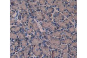 Used in DAB staining on fromalin fixed paraffin- embedded pancreas tissue (Amphiphysin Antikörper  (AA 24-240))
