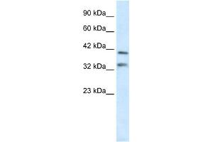 WB Suggested Anti-GSH2 Antibody Titration:  0. (GSX2 Antikörper  (N-Term))
