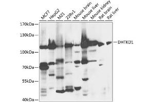 Western blot analysis of extracts of various cell lines, using DHTKD1 antibody (ABIN6132160, ABIN6139605, ABIN6139606 and ABIN6224402) at 1:1000 dilution. (DHTKD1 Antikörper  (AA 1-280))