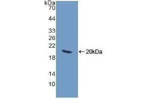 Detection of Recombinant CHGA, Human using Polyclonal Antibody to Chromogranin A (CHGA) (Chromogranin A Antikörper  (AA 15-148))