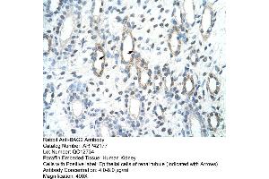 Rabbit Anti-BAG2 Antibody  Paraffin Embedded Tissue: Human Kidney Cellular Data: Epithelial cells of renal tubule Antibody Concentration: 4.