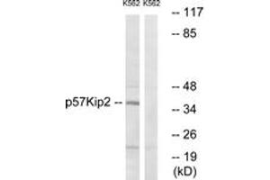 Western Blotting (WB) image for anti-Cyclin-Dependent Kinase Inhibitor 1C (p57, Kip2) (CDKN1C) (AA 267-316) antibody (ABIN2888853) (CDKN1C Antikörper  (AA 267-316))