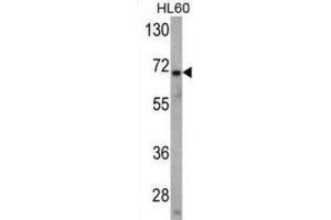 Western Blotting (WB) image for anti-Ubiquitin Specific Peptidase 2 (USP2) antibody (ABIN3001464) (USP2 Antikörper)