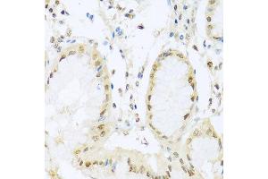 Immunohistochemistry of paraffin-embedded human stomach using PGR antibody at dilution of 1:100 (x40 lens).