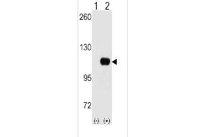 Western blot analysis of HK1 (arrow) using HK1 Antibody (C-term) (ABIN392760 and ABIN2842211). (Hexokinase 1 Antikörper  (C-Term))