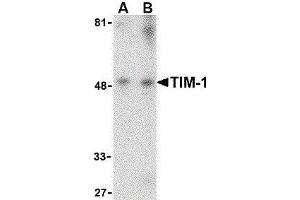 Western Blotting (WB) image for anti-Hepatitis A Virus Cellular Receptor 1 (HAVCR1) (Center) antibody (ABIN2476808) (HAVCR1 Antikörper  (Center))