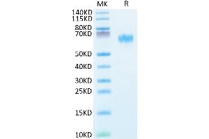 SDS-PAGE (SDS) image for Reticulon 4 (RTN4) (AA 27-447) protein (His tag) (ABIN7275359)