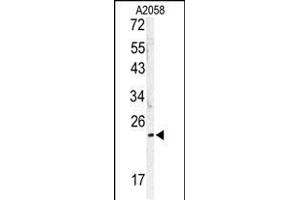 Western blot analysis of MOBKL1B antibody (C-term) (ABIN391568 and ABIN2841505) in  cell line lysates (35 μg/lane). (MOB1A Antikörper  (C-Term))