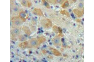 Used in DAB staining on fromalin fixed paraffin-embedded Liver tissue (FGF23 Antikörper  (AA 25-251))