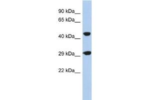 WB Suggested Anti-C22orf25 Antibody Titration: 0. (C22orf25 Antikörper  (N-Term))