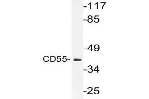 Western blot (WB) analysis of CD55 antibody in extracts from Jurkat cells. (CD55 Antikörper)
