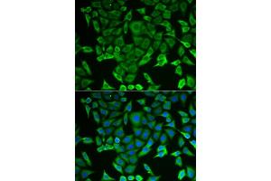 Immunofluorescence analysis of MCF-7 cells using RARS antibody (ABIN6127449, ABIN6146708, ABIN6146709 and ABIN6221913). (RARS Antikörper  (AA 1-300))