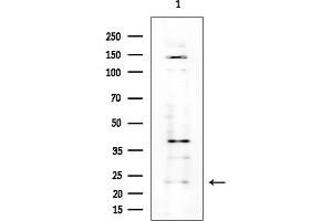 anti-Mitochondrial Ribosomal Protein S26 (MRPS26) (Internal Region) antibody
