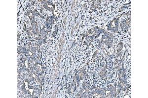 IHC analysis of HSPA6 using anti-HSPA6 antibody (ABIN7601944). (HSPA6 Antikörper  (AA 516-643))