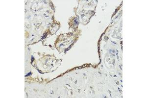 Immunohistochemistry of paraffin-embedded human placenta using H antibody (ABIN7267593) at dilution of 1:100 (40x lens). (HACE1 Antikörper  (AA 1-100))